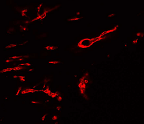 The figure shows blood vessel formation in Matrigel plugs in mice in response to basic fibroblast growth factor. Matrigel plugs were fixed in Zinc fixative and embedded in paraffin. 5 µm sections were prepared and stained for the endothelial marker protein CD31.