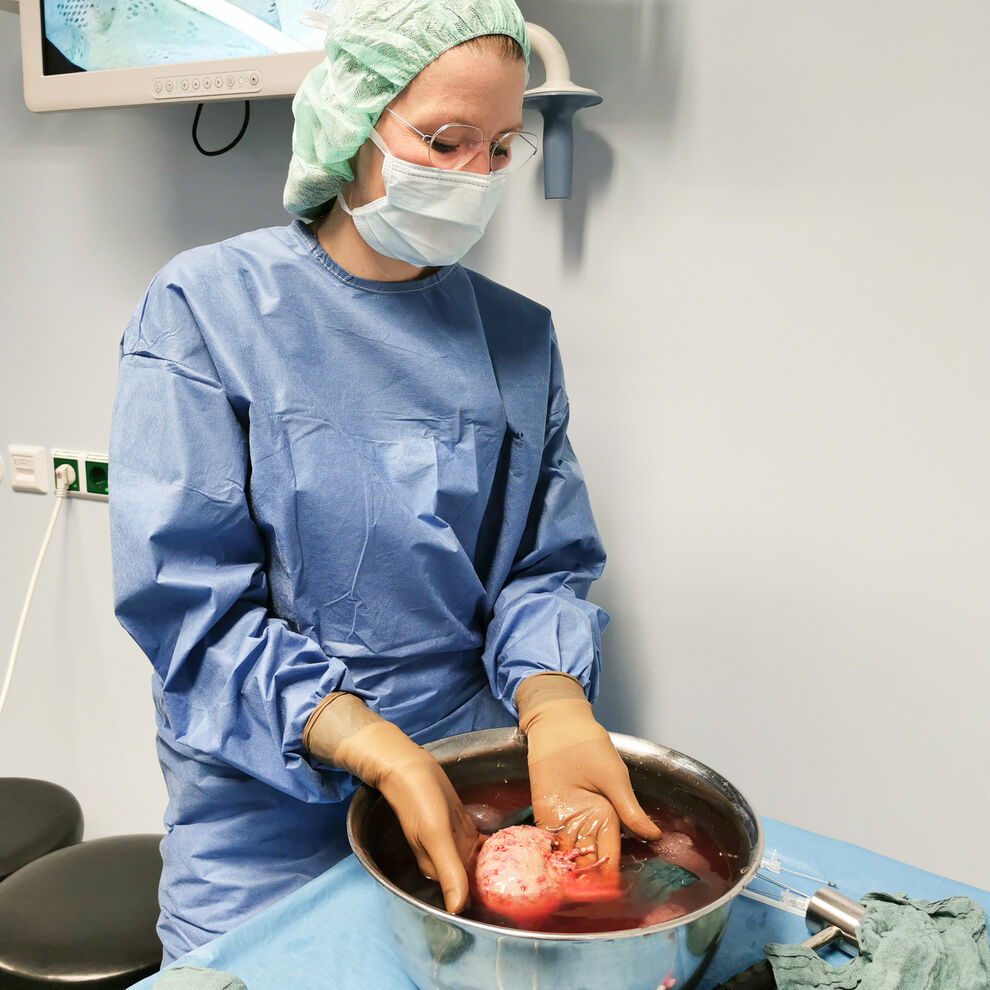 Dr. Susan Foller, Leitende Oberärztin an der Klinik für
Urologie, mit einer Niere. Foto: UKJ