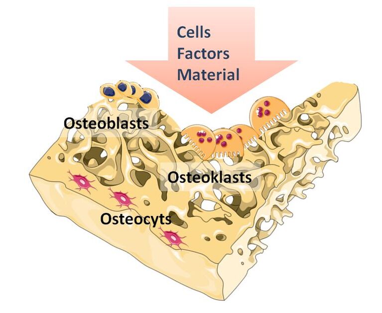 Simplified presentation of cells important for bone regeneration and factors influencing this process
Osteoblasts: bone formation
Osteoclasts: bone resorption
Osteocytes: Homeostasis
CC: smart.servier.com with modification
