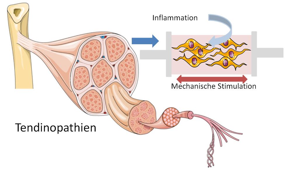 Analyse verschiedener Einflüsse auf Sehnenzellen isoliert aus humanen Tendinopathien CC: smart.servier.com mit Modifikationen 