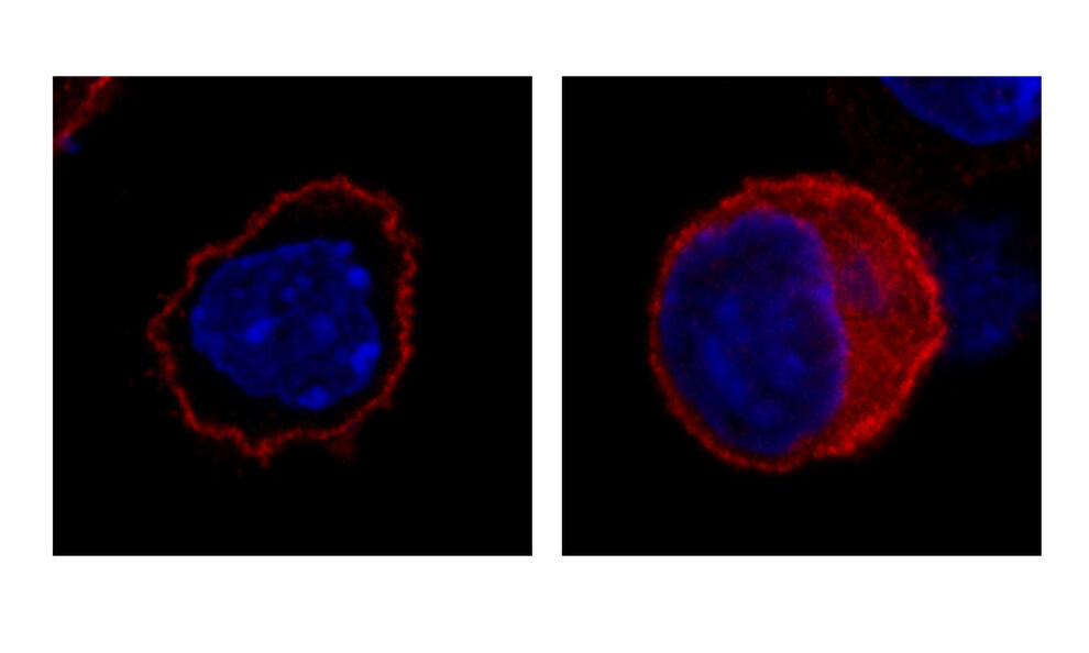 Mittels Immunfluoreszenz wird unter dem Mikroskop sichtbar, dass das intakte SLC4A10-Protein (rot, links) an der Zelloberfläche lokalisiert, während das mutierte Protein überwiegend im Zellinneren bleibt. (Aufnahme: UKJ)